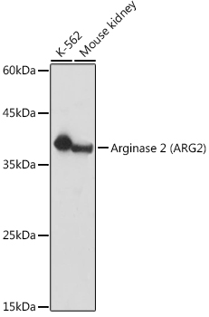 Arginase 2 (ARG2) Rabbit polyclonal antibody