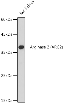 Arginase 2 (ARG2) Rabbit polyclonal antibody