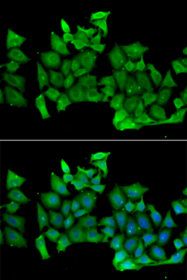 RHOH Rabbit polyclonal antibody