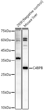 C4BPB Rabbit polyclonal antibody