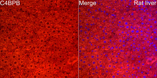 C4BPB Rabbit polyclonal antibody
