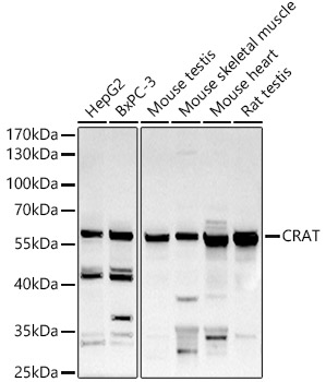 CRAT Rabbit polyclonal antibody