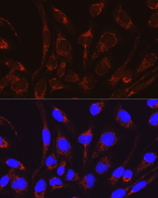 CRAT Rabbit polyclonal antibody