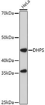 DHPS Rabbit polyclonal antibody