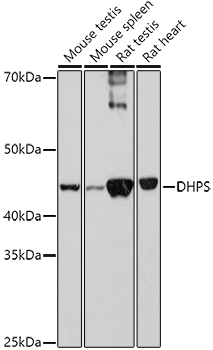 DHPS Rabbit polyclonal antibody