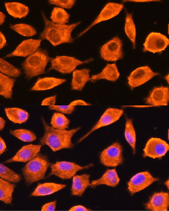 DTYMK Rabbit polyclonal antibody