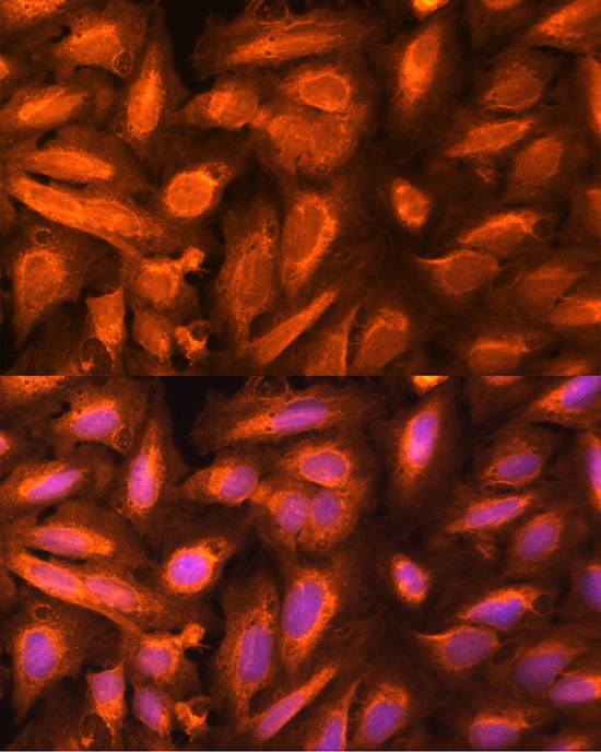 DTYMK Rabbit polyclonal antibody