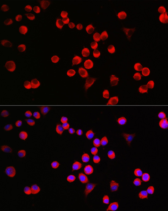 GAP43 Rabbit polyclonal antibody