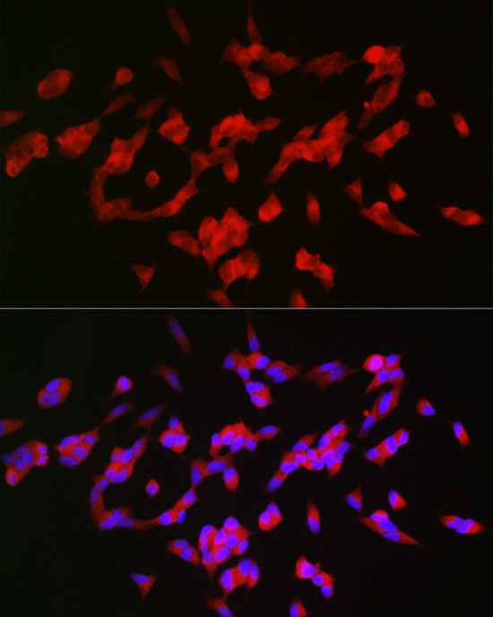 GAP43 Rabbit polyclonal antibody