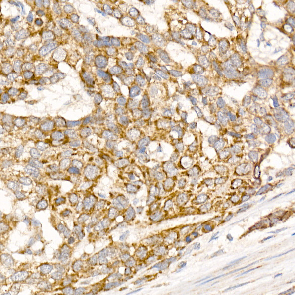 Glycerol kinase (GK) Rabbit polyclonal antibody