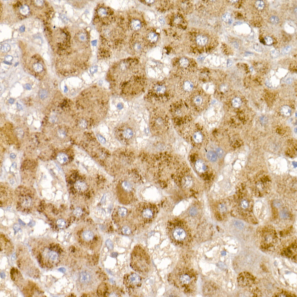 Glycerol kinase (GK) Rabbit polyclonal antibody
