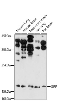 Gastrin Releasing Peptide (GRP) Rabbit polyclonal antibody