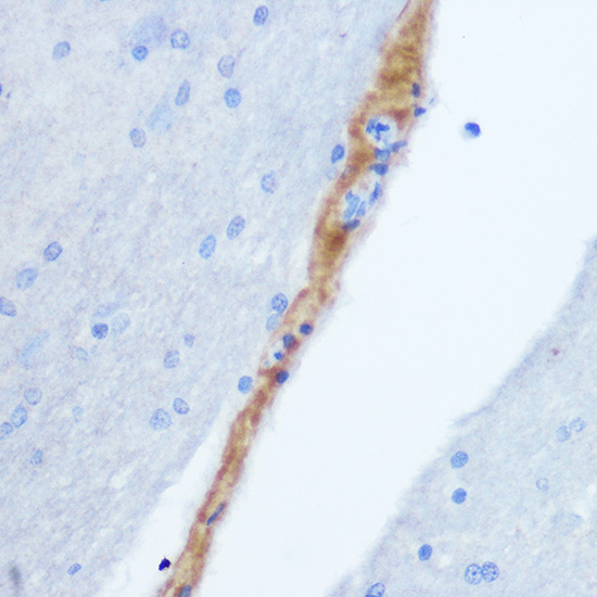 Gastrin Releasing Peptide (GRP) Rabbit polyclonal antibody