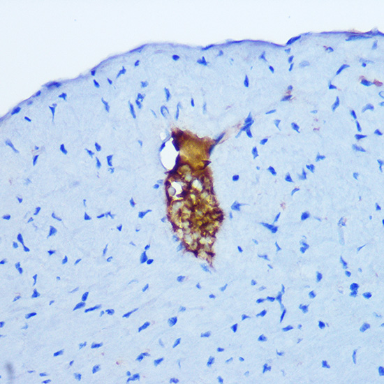 Gastrin Releasing Peptide (GRP) Rabbit polyclonal antibody