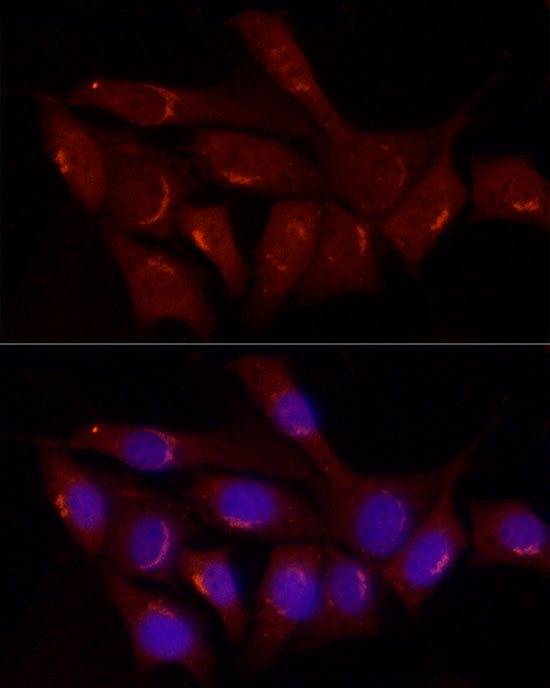 Gastrin Releasing Peptide (GRP) Rabbit polyclonal antibody