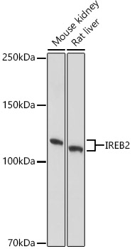 IRP2 Rabbit polyclonal antibody