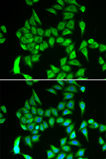 IRP2 Rabbit polyclonal antibody
