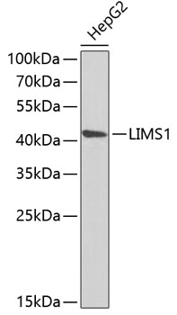 LIMS1 Rabbit polyclonal antibody