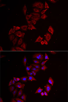 LIMS1 Rabbit polyclonal antibody