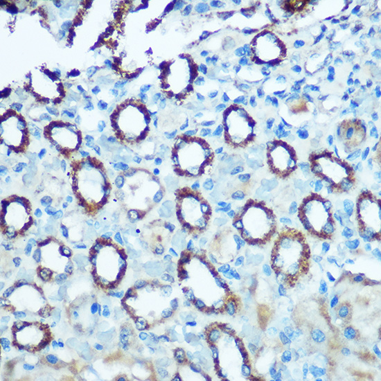 NDUFS4 Rabbit polyclonal antibody