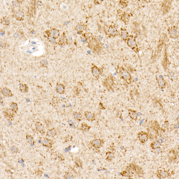 OGDH Rabbit polyclonal antibody