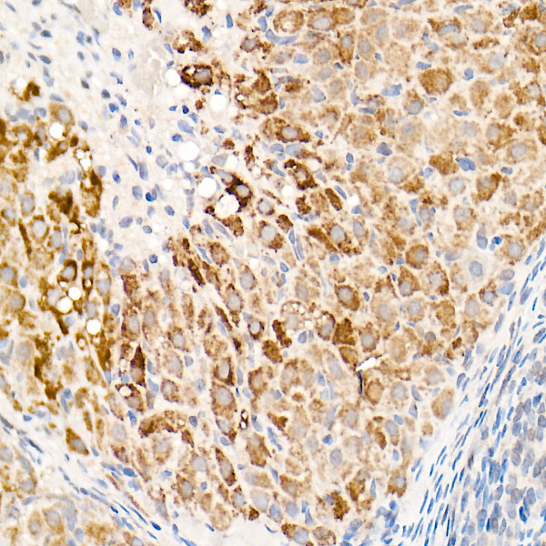 OGDH Rabbit polyclonal antibody