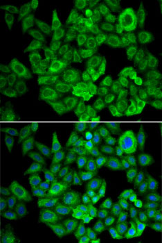 OGDH Rabbit polyclonal antibody