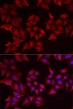 PCBD1 Rabbit polyclonal antibody
