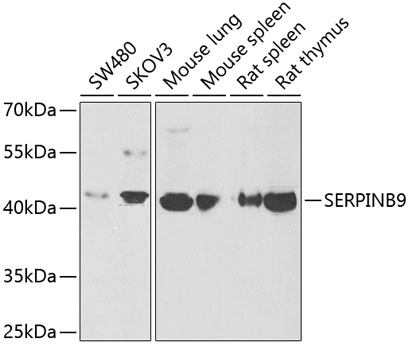 SERPINB9 Rabbit polyclonal antibody