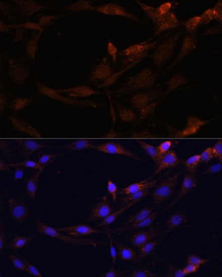 SERPINB9 Rabbit polyclonal antibody