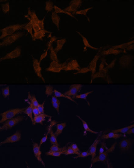 SERPINB9 Rabbit polyclonal antibody