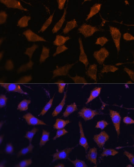 SERPINB9 Rabbit polyclonal antibody