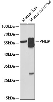 PNLIP Rabbit polyclonal antibody