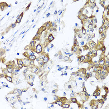 PPOX Rabbit polyclonal antibody