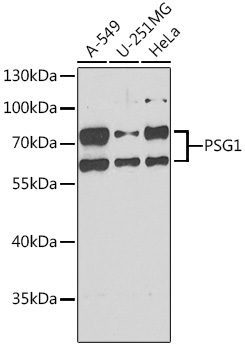 PSG1 Rabbit polyclonal antibody