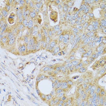 PSG1 Rabbit polyclonal antibody