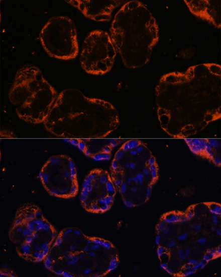PSG1 Rabbit polyclonal antibody