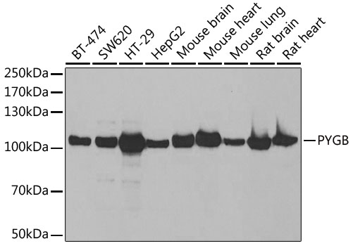 PYGB Rabbit polyclonal antibody