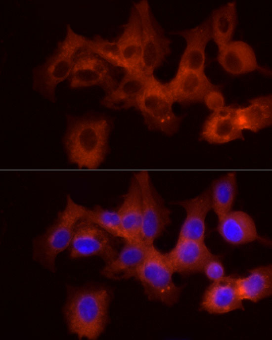PYGB Rabbit polyclonal antibody