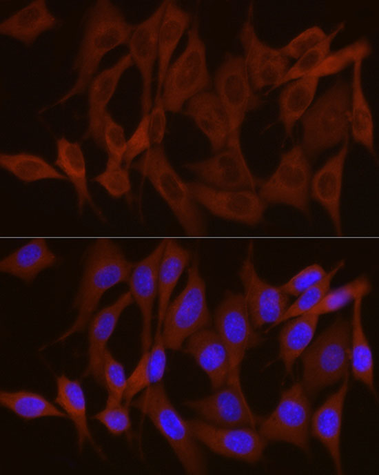 PYGB Rabbit polyclonal antibody