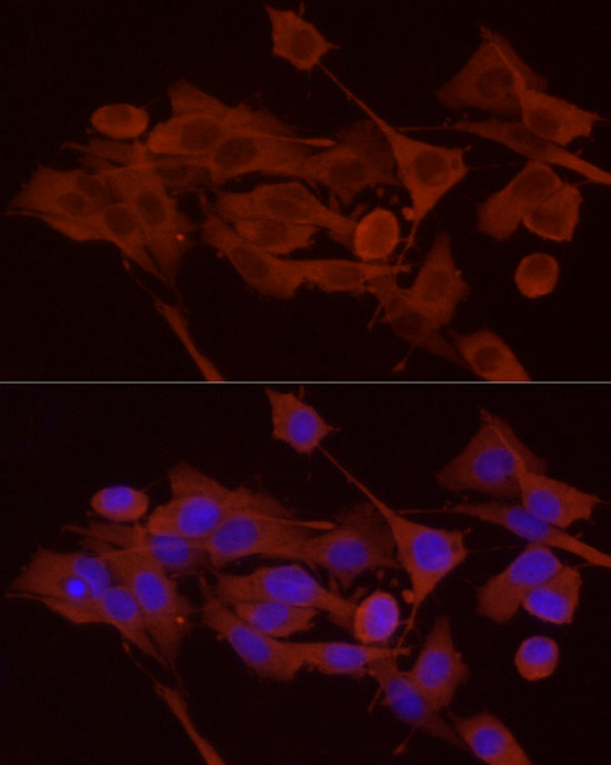 PYGB Rabbit polyclonal antibody