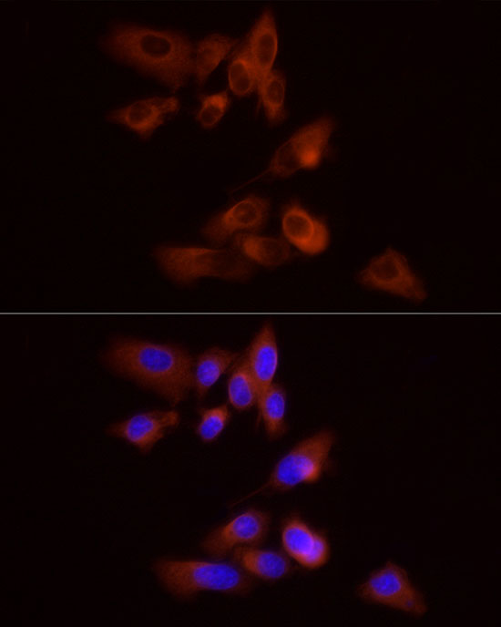 PYGB Rabbit polyclonal antibody