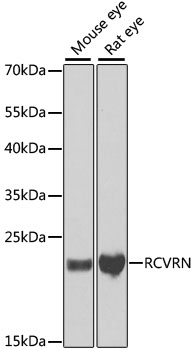 RCVRN Rabbit polyclonal antibody