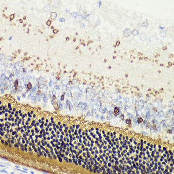 RCVRN Rabbit polyclonal antibody