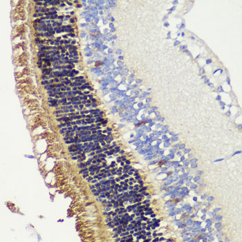 RCVRN Rabbit polyclonal antibody