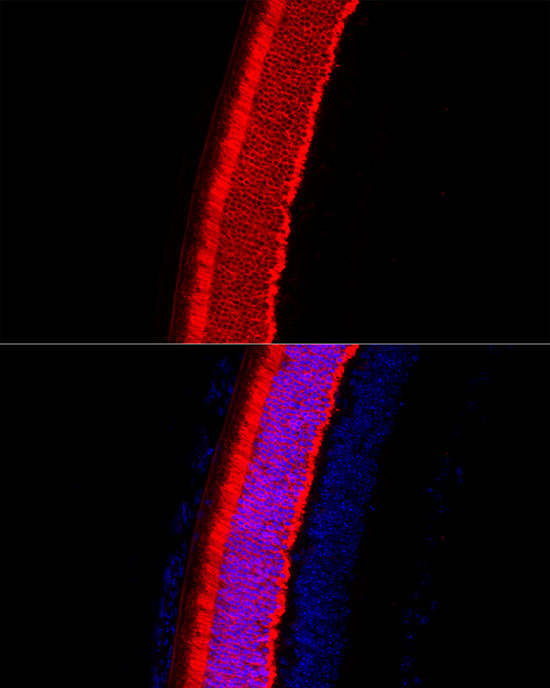 RCVRN Rabbit polyclonal antibody
