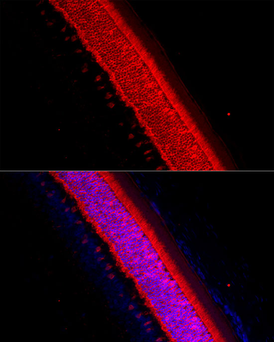 RCVRN Rabbit polyclonal antibody