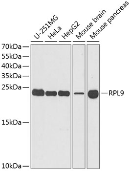 RPL9 Rabbit polyclonal antibody