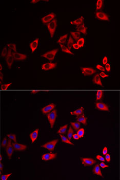 RPL9 Rabbit polyclonal antibody