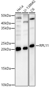 RPL11 Rabbit polyclonal antibody